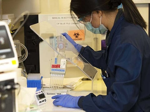 Medical laboratory scientist, Alicia Bui, runs a clinical test in the Immunology lab at UW Medicine, University of Washington, looking for antibodies against SARS-CoV-2, a virus strain that causes coronavirus disease (COVID-19) on April 17, 2020 in Seattle, US.