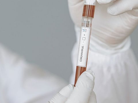 Photo for illustrative purposes purposes