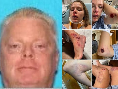 Uber driver Carolina Vargas sustained serious injuries after she jumped out of her moving car to escape being kidnapped by Christopher Miller...