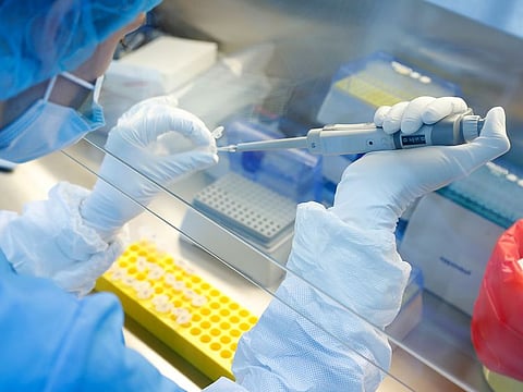 A scientist prepares samples during the research and development of a vaccine against the coronavirus disease (COVID-19). Picture for illustrative purposes only.
