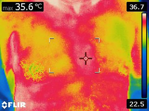 Thermal Imaging Using the Platform Developed by Dr. Rula Sharqi