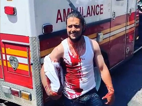 A video has gone viral showing a man in New York walking to get help with a knife stuck on his head.