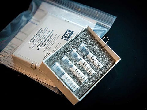 A coronavirus diagnostic test kit distributed by the US Centres for Disease Control and Prevention.