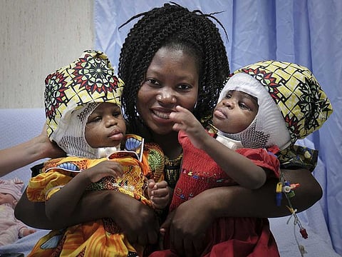 Ermine holds her twins Ervina and Prefina at the Vatican pediatric hospital in Rome.