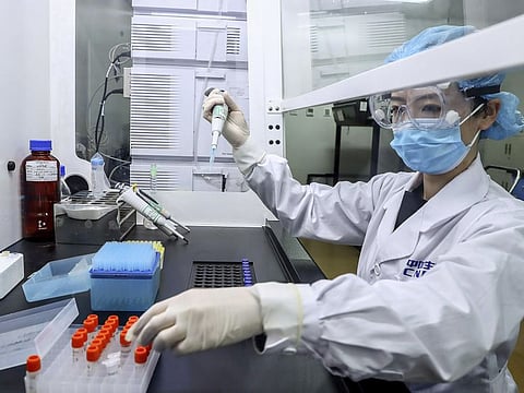 Samples of the COVID-19 inactivated vaccine were tested at a vaccine production plant (Sinopharm) in Beijing earlier