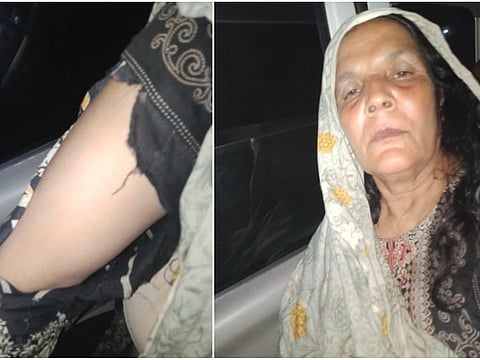 Muhammad Hasnan's family member after the attack