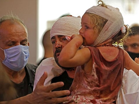 Wounded people are treated at a hospital following an explosion near the port in the Lebanese capital Beirut.