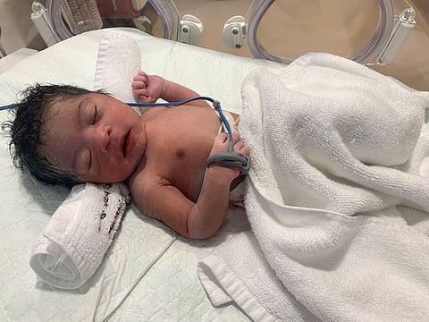 Baby Absheen at the Burjeel Hospital Sharjah NICU