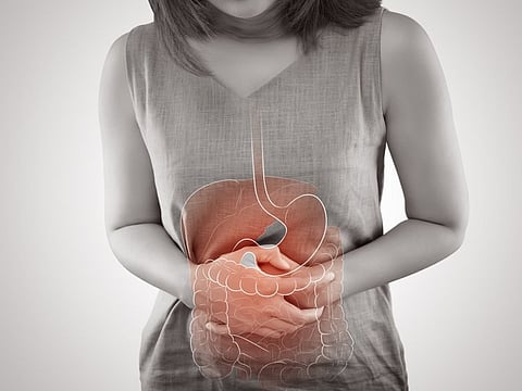 Watch what you eat because your gut has connections with the brain, doctors in UAE warn