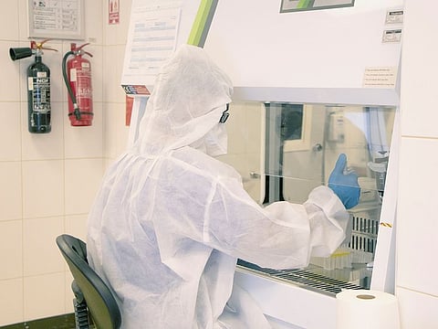 RT-PCR test for COVID-19