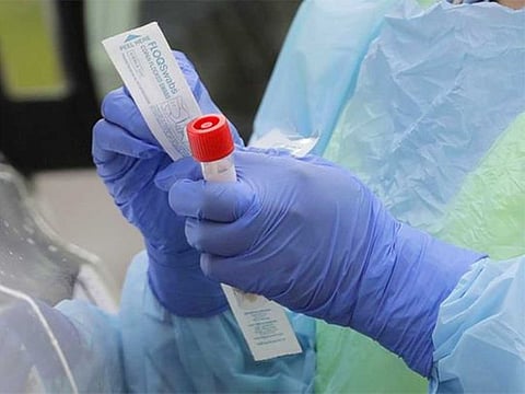 A nurse holds a vial and a swab at a drive-up coronavirus testing station.
