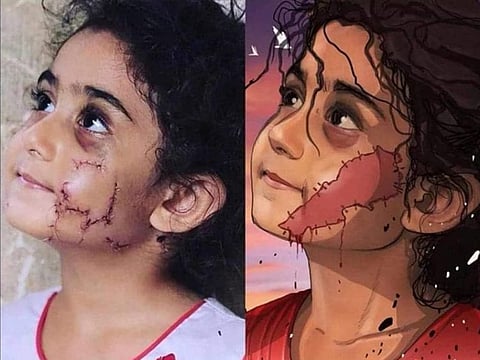 Yara, 4, was lucky to survive the deadly blast in Beirut which killed 180 people.