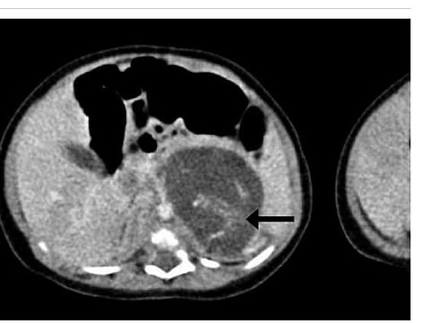 The use of embryonic and fetal cells from aborted babies in the pharmaceutical industry and in medical research is well-documented.