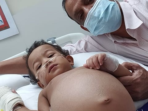 A bone-marrow transplant in India can cost around Rs4 million (Dh201,816), Aahil's father Nazeer Ahamed said.