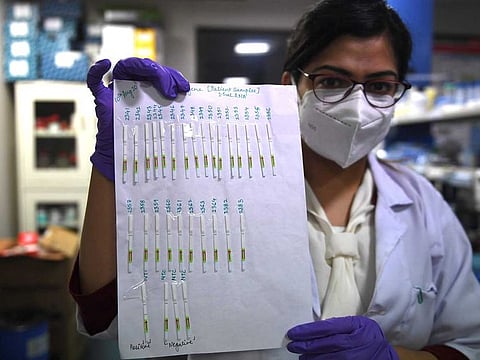 In this file photo taken on October 7, 2020, a researcher holds a sheet with paper strip samples for COVID-19 coronavirus tests developed by the CSIR-Institute of Genomics and Integrative Biology (IGIB) which could give results at a similar speed of pregnancy tests, at a laboratory of the IGIB in New Delhi.