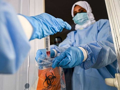 Photo for illustrative purposes.