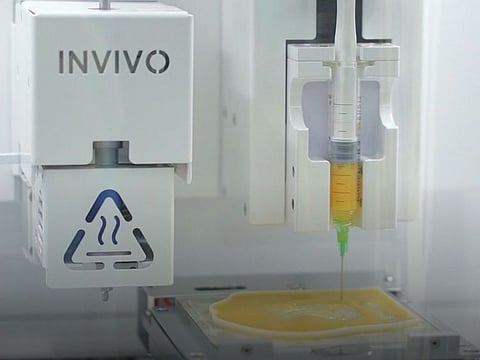 Demonstrating its use, a team of doctors performed the region’s first surgery using a Bioprinter.