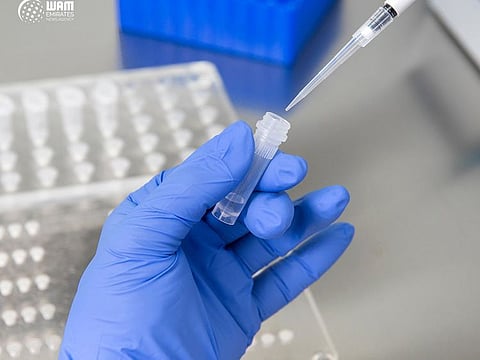 The Department of Health — Abu Dhabi (DoH), the emirate’s health regulator also released eligibility criteria to sign up for the trials.