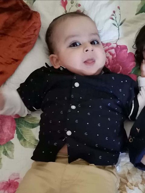 Surgeons at Medeor Hospital not only carried out the complex surgery on baby Abdul Hadi, excising the lesion, but also made sure they were able to release the spinal cord that was tethered abnormally.