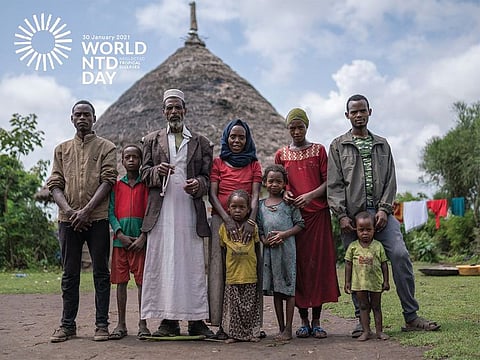 The critical need to end neglected tropical diseases (NTDs) NTDs affect more than 1.7 billion people – often those living in extreme poverty, in remote communities, and without access to basic needs like clean water – and cost developing economies billions of dollars every year