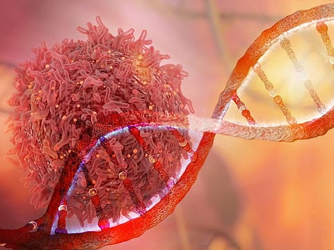 Image for illustrative purpose only