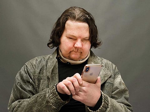 Joe DiMeo uses his cellphone while posing for a portrait, Monday, Jan. 25, 2021, in New York, six months after an extremely rare double hand and face transplant. Almost six months after a rare face and hands transplant, Joe DiMeo is relearning how to smile, blink, pinch and squeeze. The 22-year-old New Jersey resident had the operation last August, two years after being badly burned in a car crash.