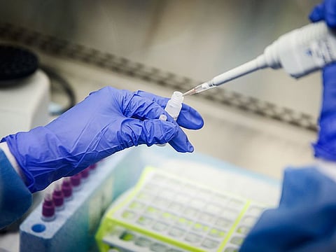 In this March 11, 2020 photo, a laboratory technician prepares COVID-19 patient samples for semi-automatic testing at Northwell Health Labs, in Lake Success, New York.