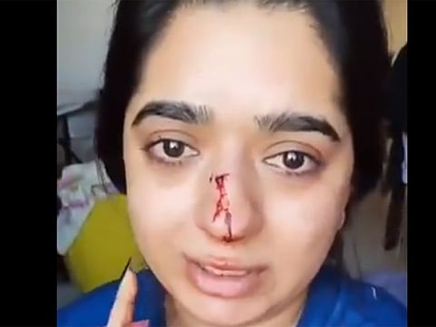 A screengrab of the video shared on twitter by Hitesha Chandranee