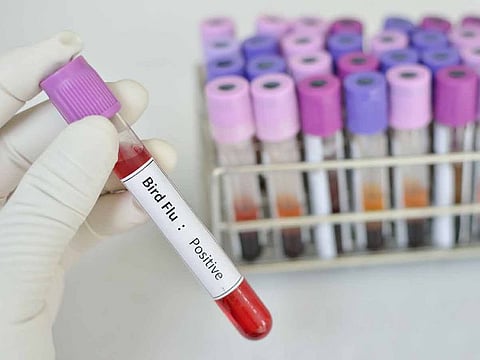 The five countries are Kazakhstan, Italy, Croatia, the Philippines and Finland. Illustrative image.