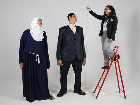 Considering Mohamed and Huda are still growing, they may need to undergo a surgery to stop their growth.