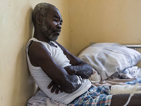 A man sits on a bed at the "Communautaire de Référence" hospital in Port-Salut in Port-Salut, Haiti on August 18, 2021.