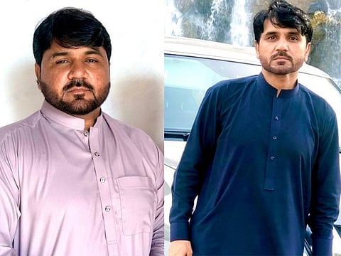 Zahid Badshah before and after