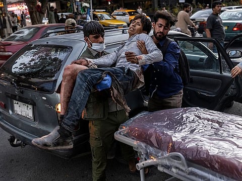 A person wounded in a bomb blast outside the airport in Kabul, Afghanistan on Thursday, Aug. 26, 2021, arrives at a hospital in Kabul.
