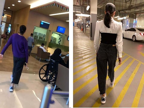 Patient Hoor Abu Baker Youssef Elnayed before and after the surgery.