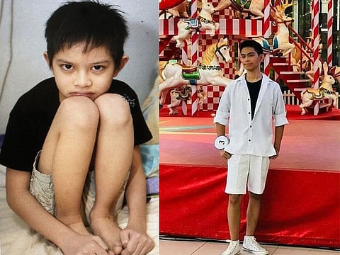 At 10 (left), Gil Merced could not stand or walk without collapsing. He would just squat, keep his legs folded and be carried around because of a congenital heart condition. However, he underwent an open heart surgery and today, seven years later, he is leading a normal life. Among the things he loves to do is take to the catwalk where he shares his inspiring story.