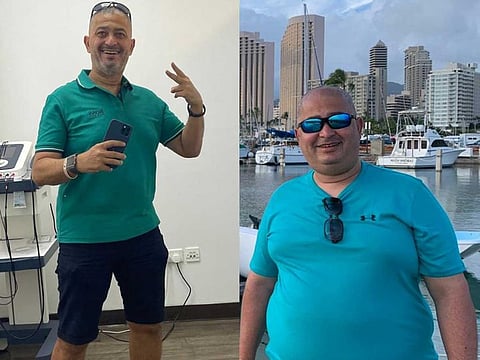 Before and after: Dr Sameh Ghazy.