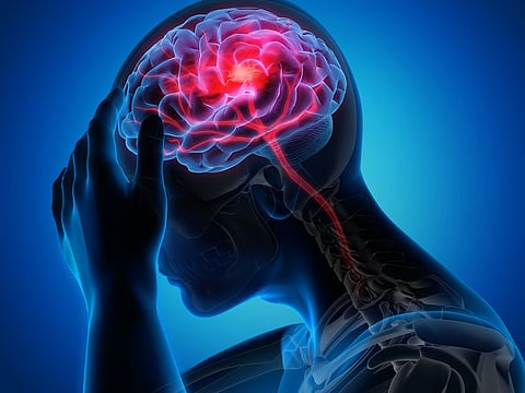 A stroke can happen if the blood supply to a part of the brain is cut off