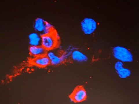 A projector image showing immunofluorescence staining of Omicron infected Vero E6 cells is displayed on a screen in Hong Kong on December 1, 2021. Researchers at the University of Hong Kong have succeeded in isolating the omicron coronavirus variant from clinical specimens, making them the first research team in Asia to do it, the university said.