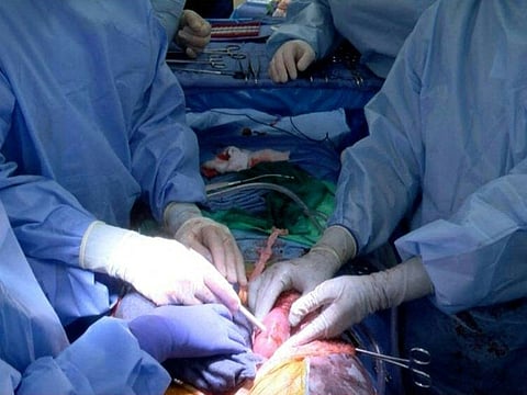 This photo provided by the University of Alabama (UAB) shows adopplerprobe used to assess blood flow inside the right porcine (pig) kidney after transplantation into the brain-dead recipient.