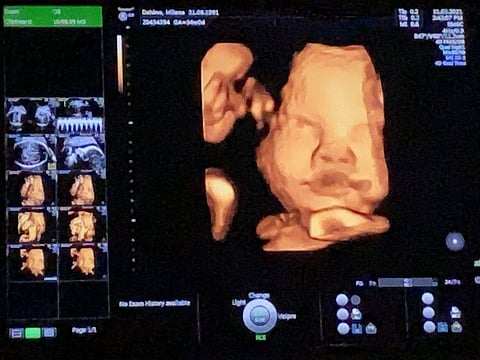 Millena Kristie shares her sonogram photo.