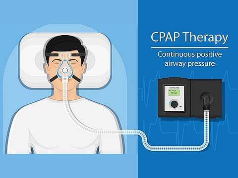 A CPAP machine must be used only when all other efforts fail.