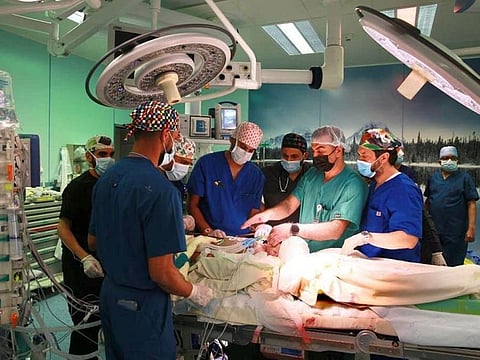 The baby boys, Yussef and Yassin, were “conjoined in several organs”, and some 24 doctors were involved in the operation to separate them.