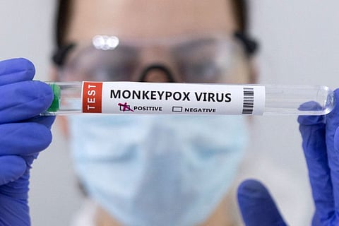 Test tubes labelled "Monkeypox virus positive" are seen in this illustration taken May 23, 2022. REUTERS/Dado Ruvic/Illustration