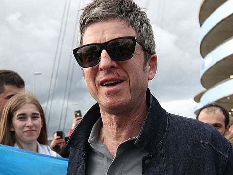 Former Oasis rock star Noel Gallagher received stitches in his face after being accidentally headbutted by Ruben Dias' father as the pair celebrated Manchester City's thrilling comeback to clinch the Premier League title on Sunday.