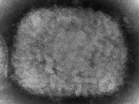 A 2003 electron microscope image made available by the Centers for Disease Control and Prevention shows a monkeypox virion.