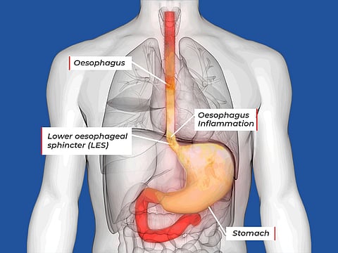 Vijith Pulikkal/Gulf News