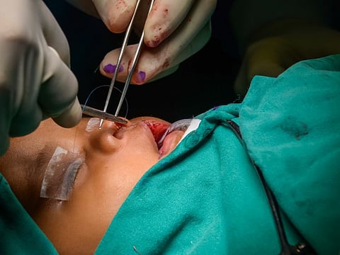 As part of the Operation Smile UAE initiative, twelve patients will receive life-changing surgeries for their cleft conditions.