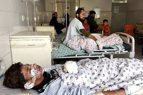 Afghan men suffering from burn injury receive treatment at a hospital after getting as an oil tanker caught fire a night before at Salang pass tunnel in Charikar city on December 18, 2022.
