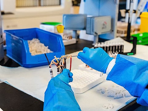 Volunteer hours for blood donors will be calculated based on the type of blood donation. Two hours will be credited for general blood donation, and three hours for donating platelets