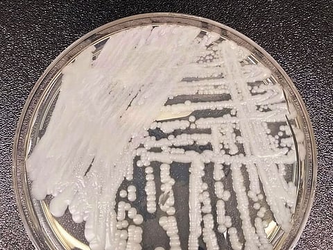 A strain of Candida auris cultured in a petri dish at a CDC laboratory.